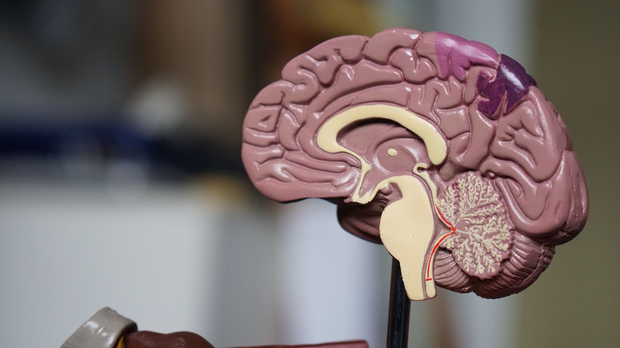 Umělá inteligence pomůže s diagnostikou demence