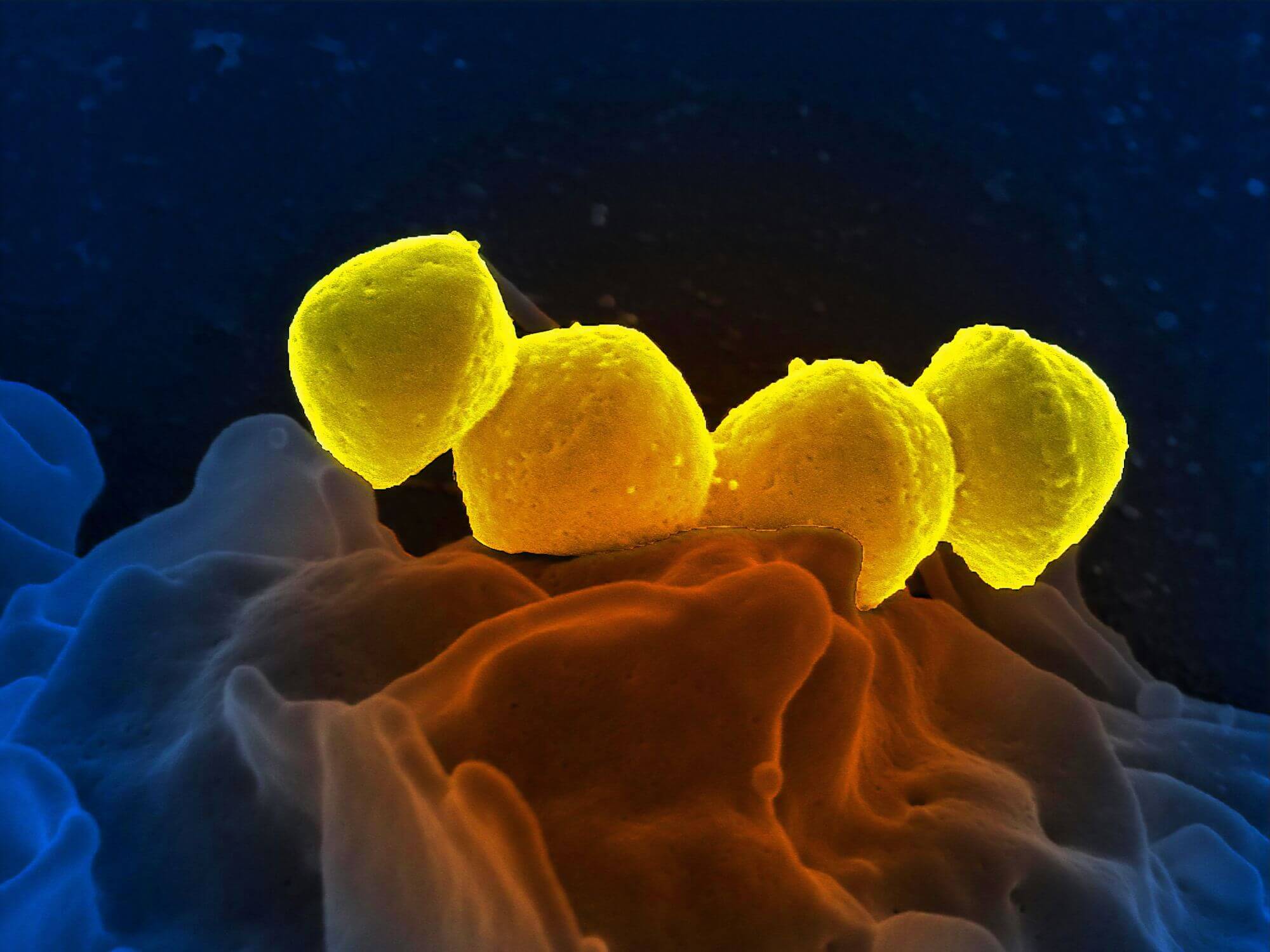 Mikroplasty napomáhají šíření genů antibiotické rezistence mezi bakteriemi