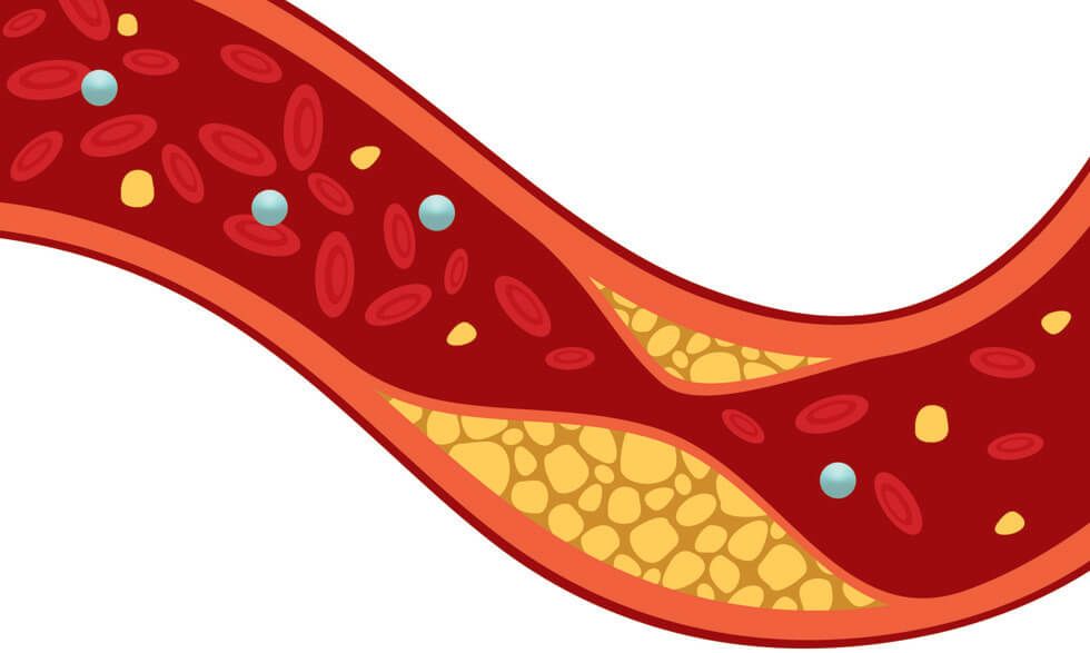 Je znám nový mechanismus, kterým působí léky proti bolesti. Zásadní roli hraje protein NRF2