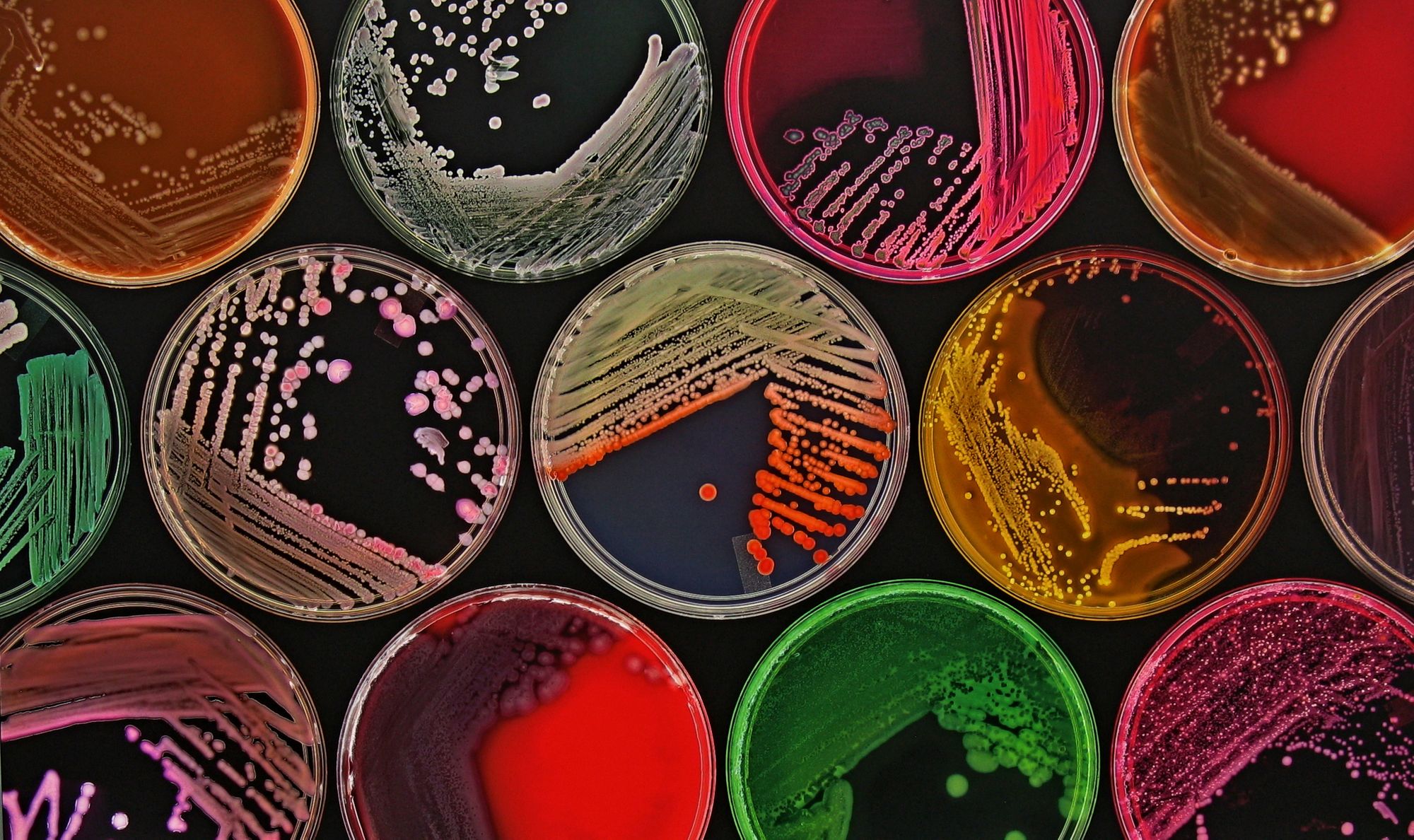 Na obávané bakteriální biofilmy by mohla platit elektřina