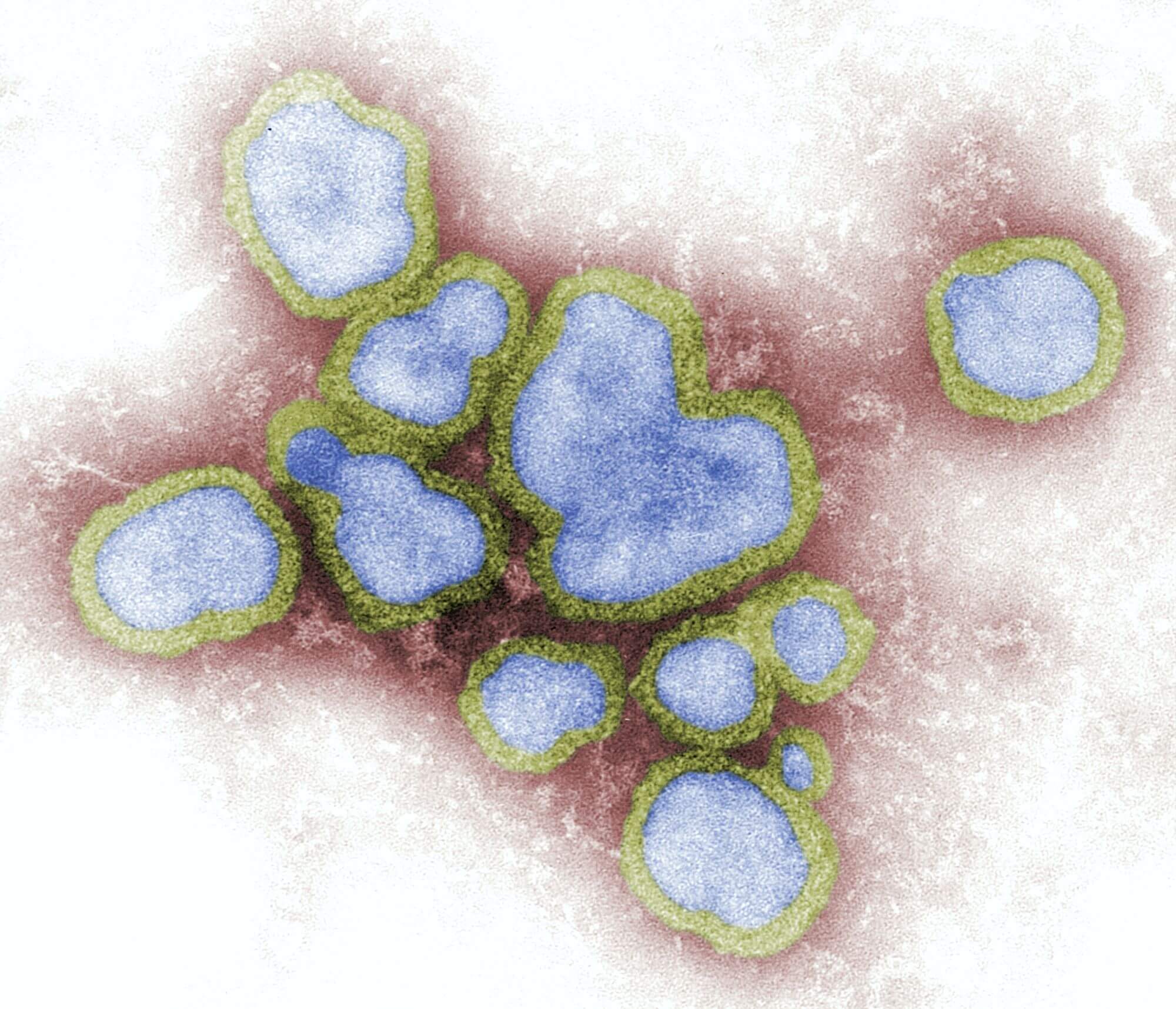 Virus chřipky přímo poškozuje srdce, potvrdila nová studie